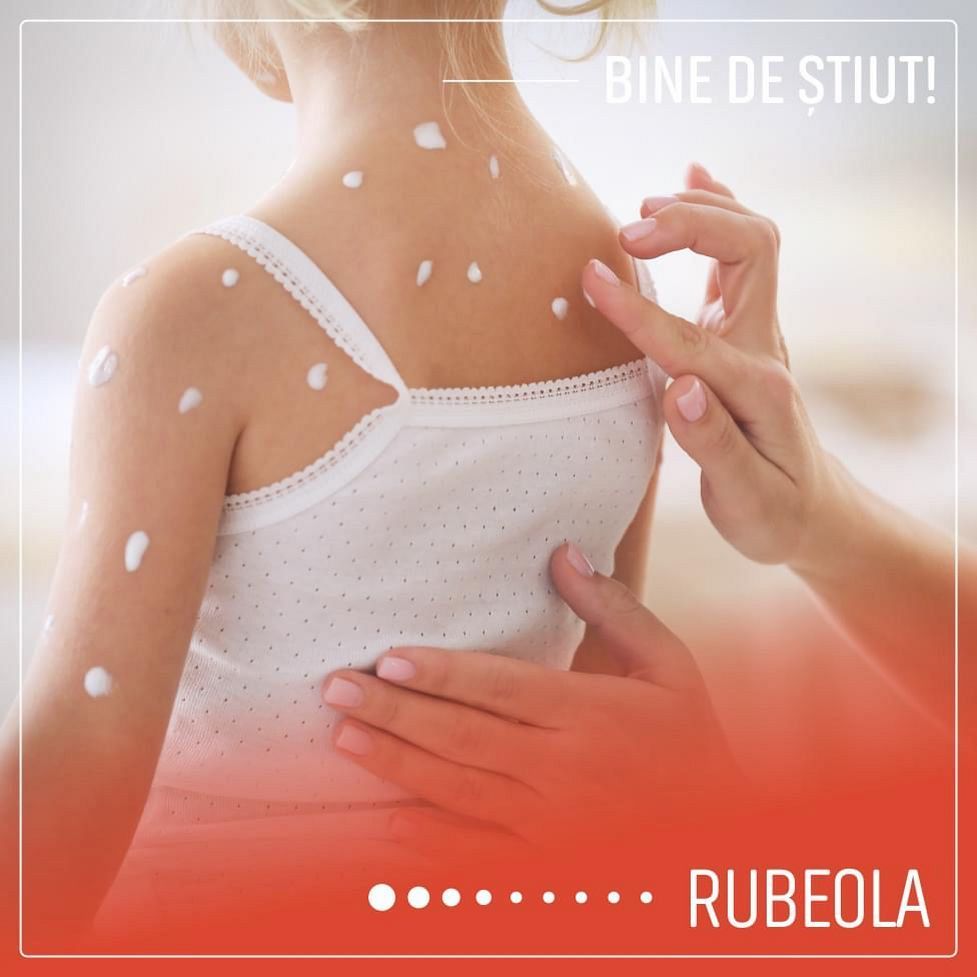 Preventing Rubella: Vaccination Recommendations and Tips